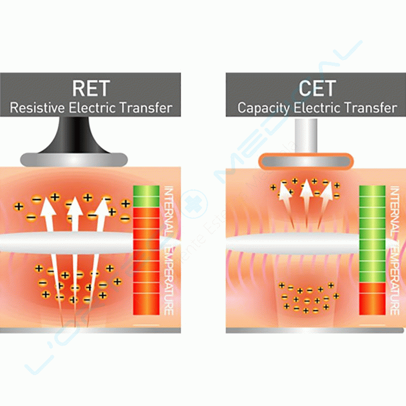 lortec medical 5-MONO CET + RET